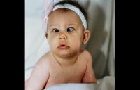 Infant Strabismus - strabismus crossed eye pediatric optometry vision therapy vivid vision childrens vision squint patient success story strabismus surgery high resolution